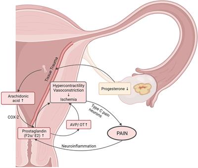 Repurposing of Bryophyllum pinnatum for dysmenorrhea treatment: a systematic scoping review and case series